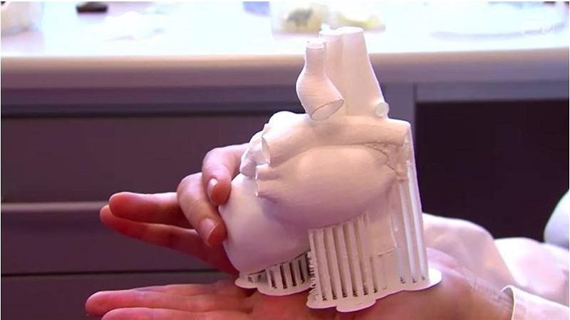 Drukowane modele 3D serca pomagają w skomplikowanych operacjach