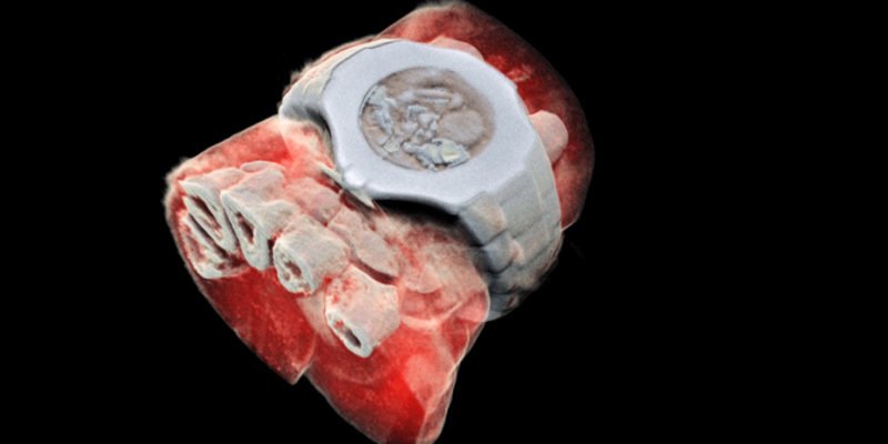 Kolorowy rentgen w 3D